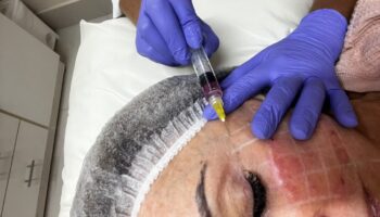 Laserterapia