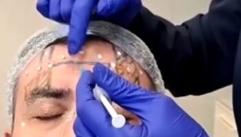 Laserterapia 3
